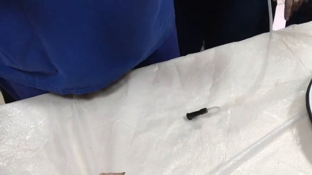 Дренирование напряжённого пневмоторакса у новорождённого смотреть онлайн
