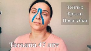 тейпы: брыли, носогубки