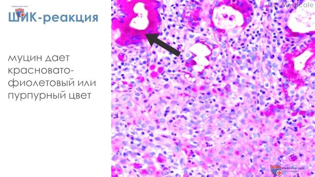 3.1 Методы окрашивания гистологических материалов.mp4 смотреть онлайн