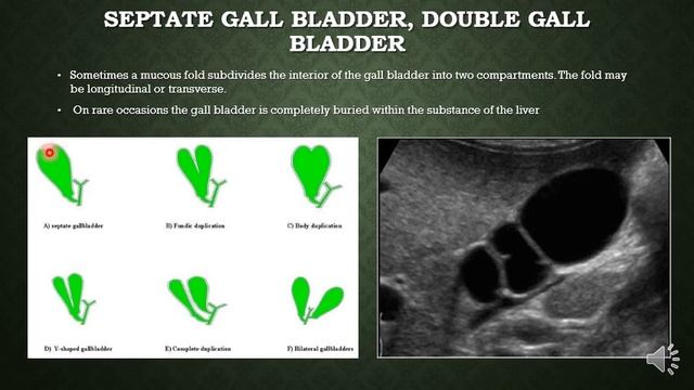 Development of GIT part 3 смотреть онлайн