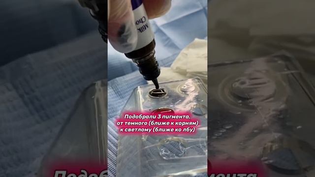 Залысины на голове что делать? Камуфляж залысин смотреть онлайн