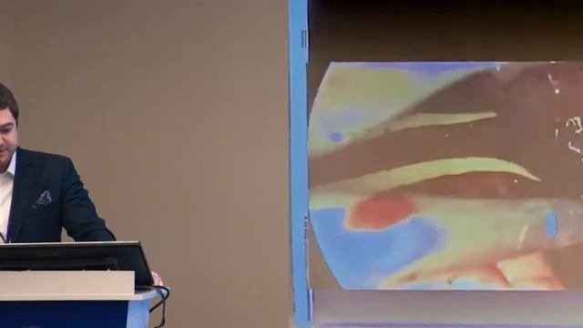 Технические аспекты бронхо-ангиопластических и резекций карины при однопортовой торакоскопии смотреть онлайн