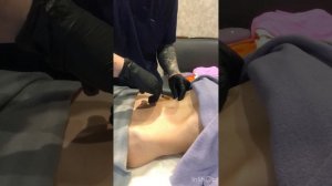 Липолитики в живот