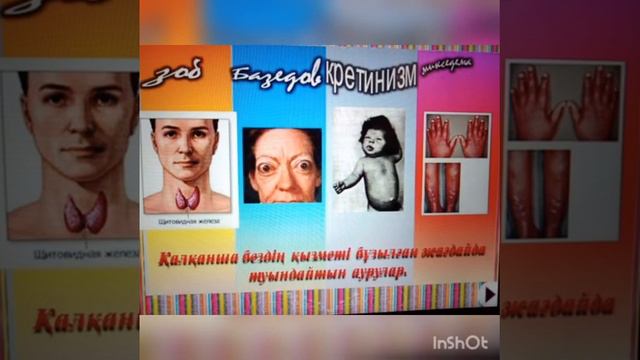 Антропогендік фактор түсінігі: антропогендік фактордың кері әсері смотреть онлайн