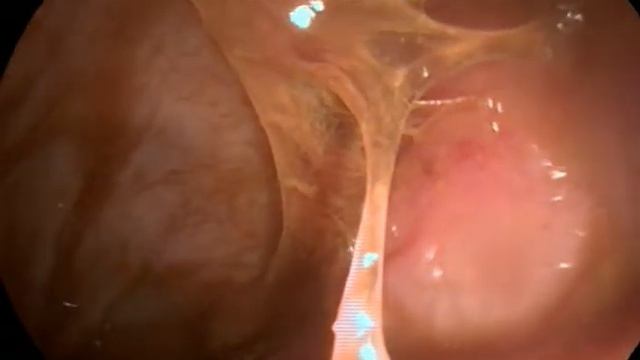 Колоноскопия собаки смотреть онлайн