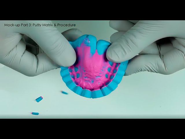 Создание mock-up с использованием 3Shape Dental System смотреть онлайн