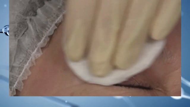 Постакне от А до Я. Тактика ведения пациентов. Современные протоколы и методы коррекции.