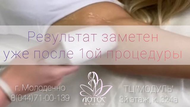 Эпиляция в Молодечно смотреть онлайн