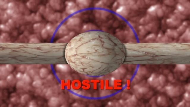 What Is a Lymph Node? смотреть онлайн