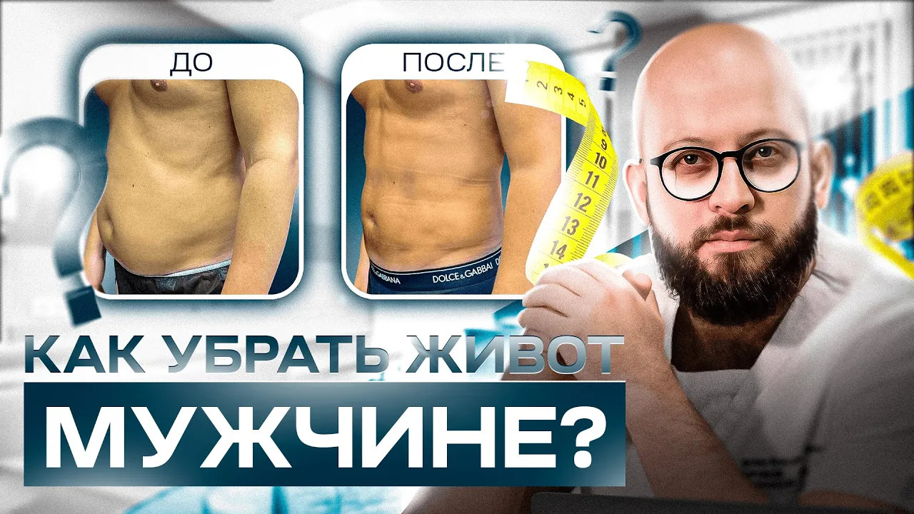 МУЖСКАЯ ЛИПОСАКЦИЯ ЖИВОТА - все что нужно знать. Как убрать живот мужчине и быть идеальным? смотреть онлайн