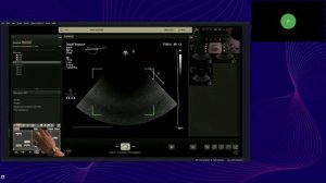 Проведение стресс-эхокардиографии на ультразвуковых системах Philips EPIQ, Affiniti