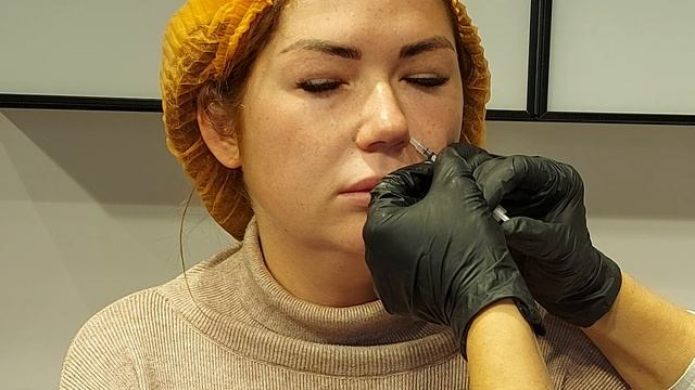 28.10 Токсин при динамической ассиметрии.