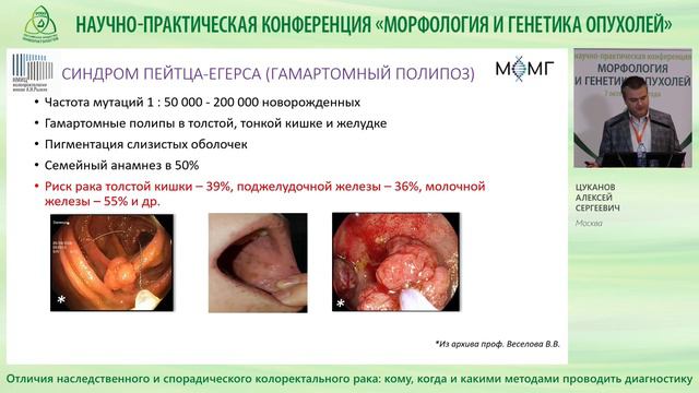 Отличия наследственного и спорадического колоректального рака смотреть онлайн