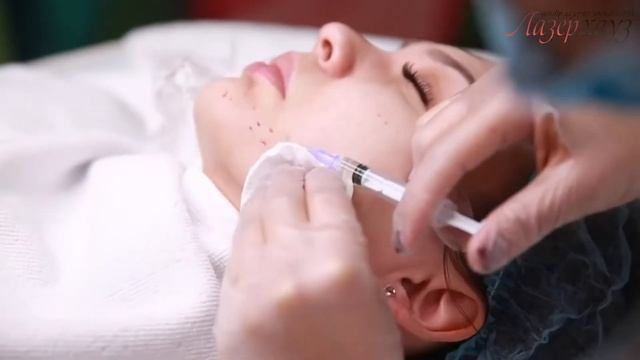 Мезотерапія