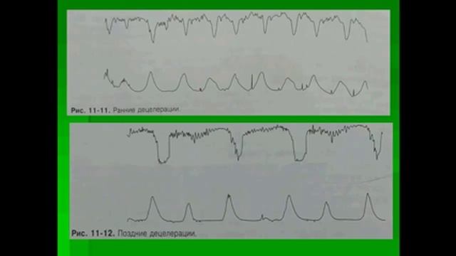 Техники релаксации для ума