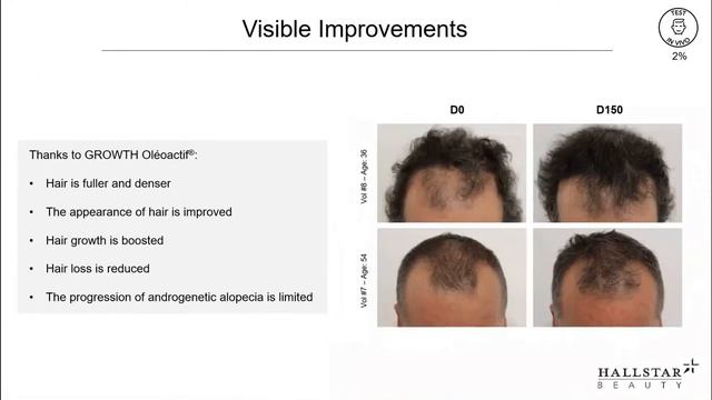 Webinar PRODOTTI GIANNI Growth Oléoactif® per ciglia piene e capelli folti смотреть онлайн