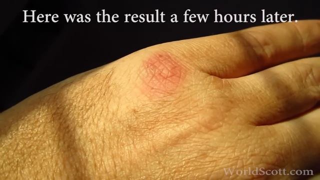 Horse-fly bites and wounds me: an experiment and explanation смотреть онлайн