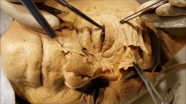 Веки и слезный аппарат (анатомирование) смотреть онлайн