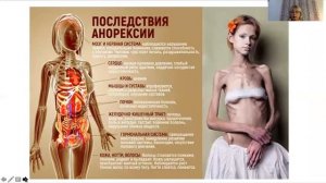 Методы обследования в детской гинекологии..mp4