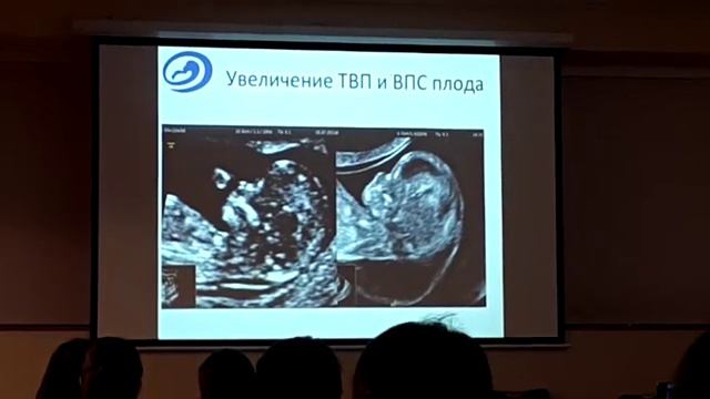 Екатерина Некрасова 💜(5) смотреть онлайн