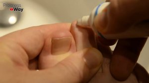 Эта ЯДРЁНАЯ Советская Мазь Разъест Весь Грибок с Ногтей! Есть в Любой Аптеке!