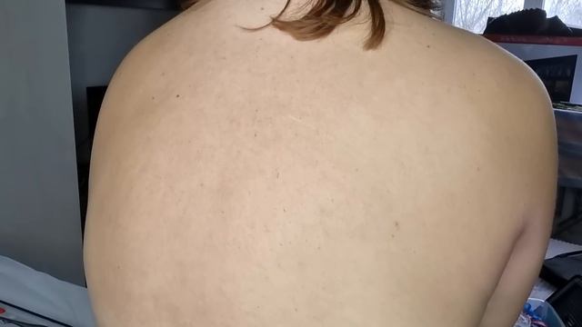 АСМР/Тесты на чувствительность/Осмотр спины/Back Examination/Cranial Nerve Exam