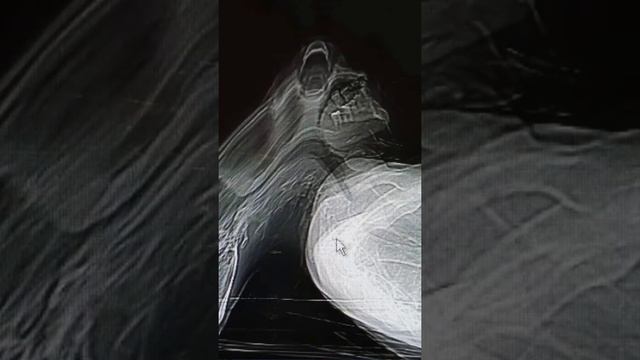 Фото ДУШИ ЧЕЛОВЕКА переполошило весь госпиталь смотреть онлайн