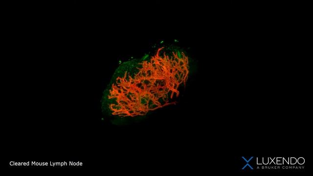 Cleared Mouse Lymph Node смотреть онлайн