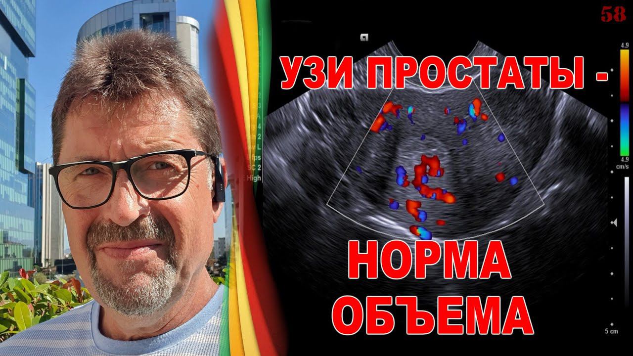 Простатит  - методы обследования. УЗИ простаты - норма объема. Как относиться к измерениям простаты.