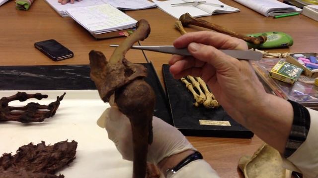 Суставы верхней конечности смотреть онлайн