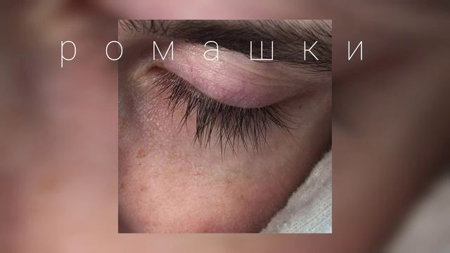 ромашки. *авторское* смотреть онлайн