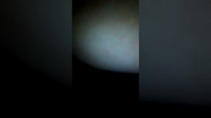 Обнаружили мастит у кошки/везём в ветклинику!
