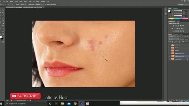 Healing tools and brush tool in photoshop cs6||telugu||adobe||photoshop|| смотреть онлайн