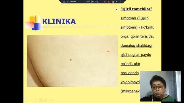 Surunkali pankreatit смотреть онлайн