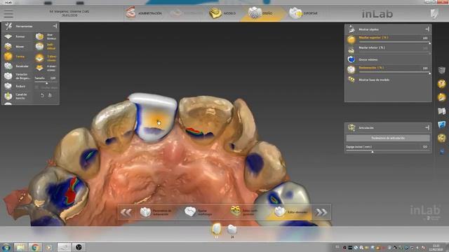 Diseño 3D Cad cam in lab sirona SW19 - TECNICA DENTAL DIGITAL 2020 смотреть онлайн