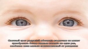 Когда меняется цвет глаз у новорожденных? Таблица определения цвета глаз