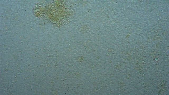 Pediatrics. Staphylococcus aureus. Microbiological testing of feces. смотреть онлайн