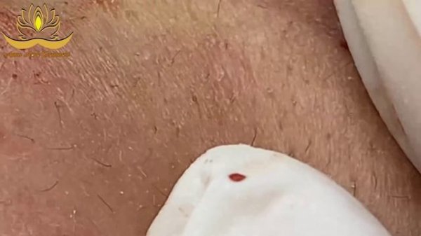 Most Satisfying and Relaxation with An Spa Video #123