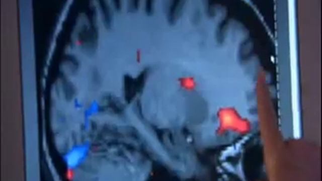 How the Brain Works: Basal Ganglia смотреть онлайн