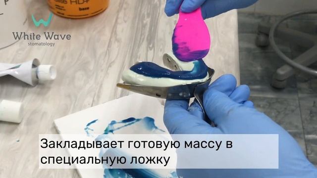 Как делают слепки (оттиски) зубов. Протезирования зубов. Коронка Emax