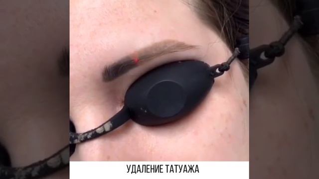 Удаление татуажа в салоне красоты SIX RULES город Владимир смотреть онлайн