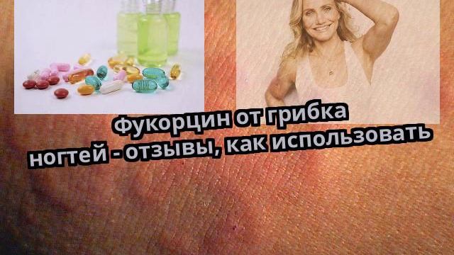 Фукорцин от грибка ногтей - отзывы, как использовать смотреть онлайн