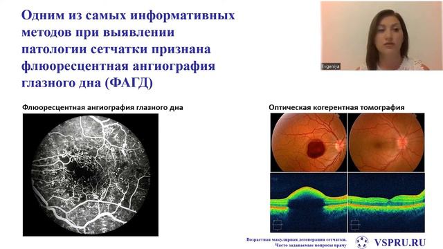Видео лекция ВМД 2022.2 «ВМД. Самые часто задаваемые врачу вопросы» смотреть онлайн