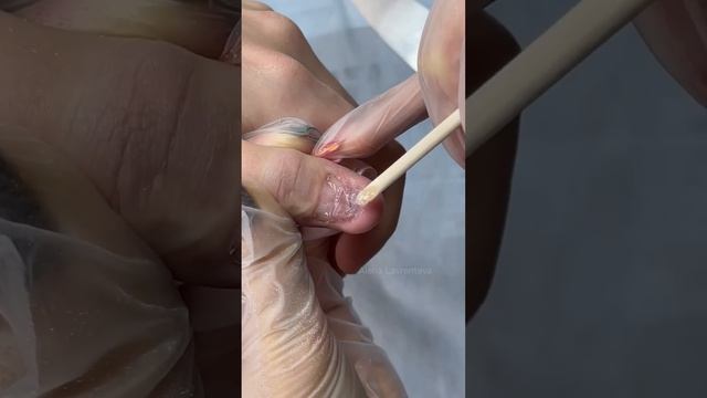 Неудачно удалил бородавку и теперь ноготь не растет/ Протезирование ногтей  #nails #маникюр #гельла