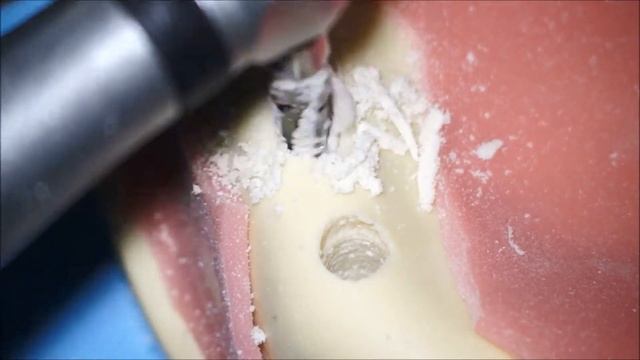 Insertion of a Nobel Replace Regular Platform Implant in simulation laboratory смотреть онлайн