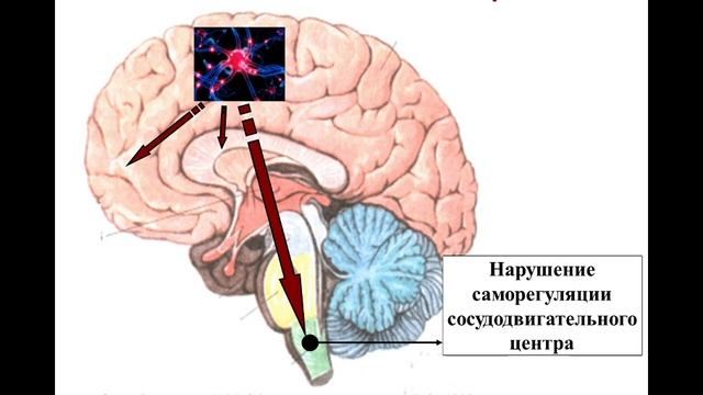 Лекция 13.
Все факультеты.
Сосудистый тонус. смотреть онлайн