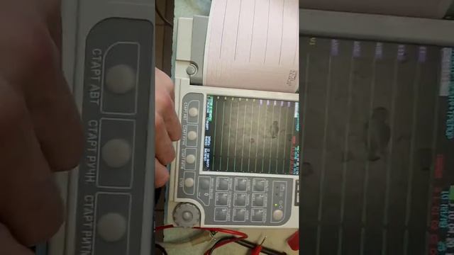 Ремонт ЭКГ электрокардиографа и техническое обслуживание смотреть онлайн