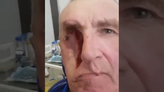 Этот мужик сделал себе лицо из пластика ?? смотреть онлайн