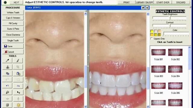 SNAP Instant Cosmetic Imaging Software