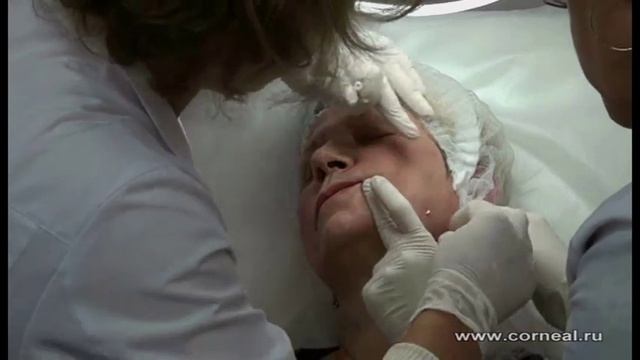 Учимся ставить мезонити Essellab